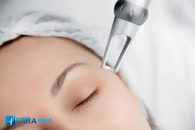 بهترین لیزر برای پاک کردن تتو چیست؟