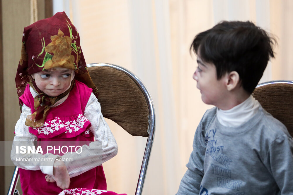 بازدید وزیر خارجه از خانه بیماران پروانه‌ای