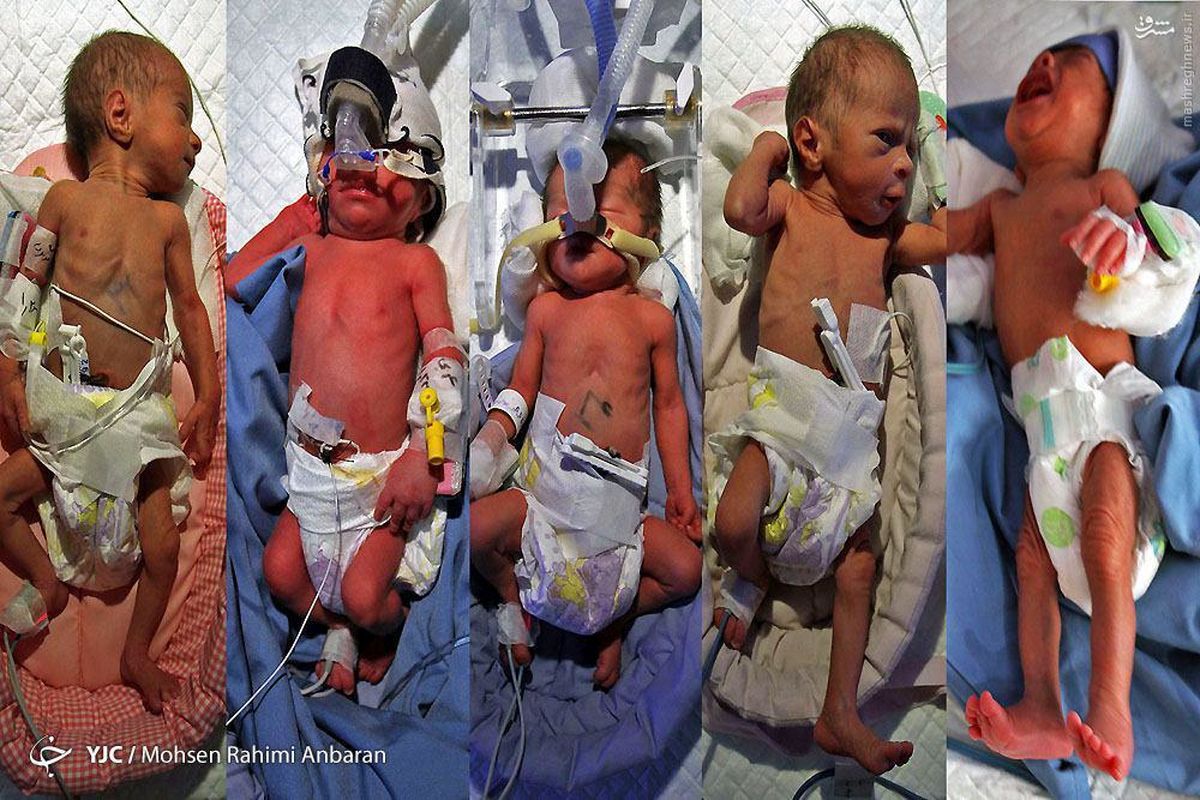 عکس: تولد 5 قلوها در مشهد