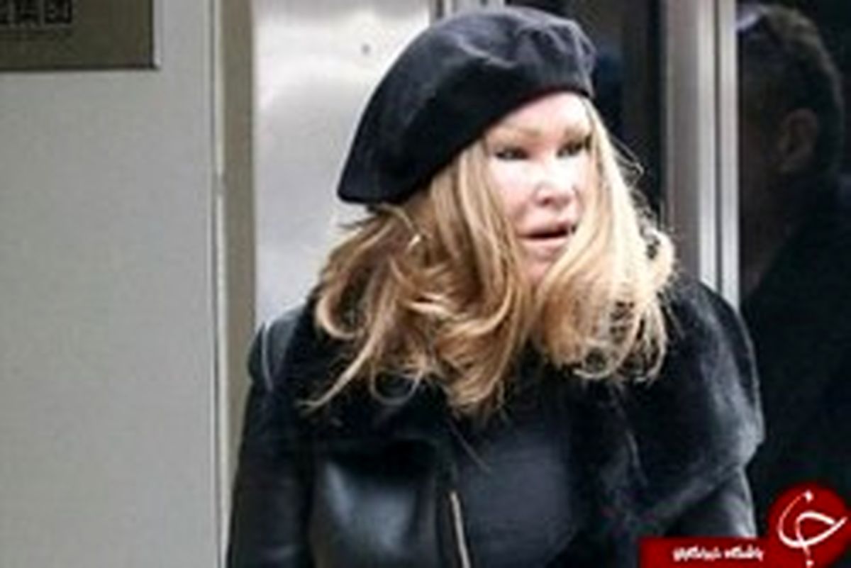 اعتیاد عجیب یک زن به گربه شدن دردسرساز شد! +تصاویر