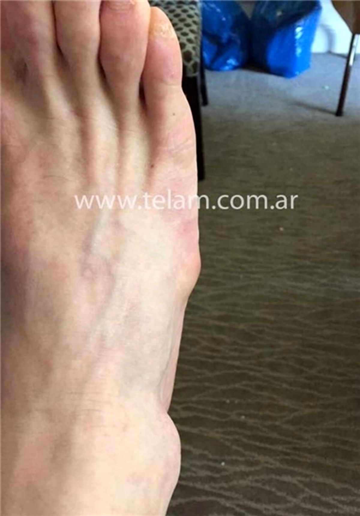 دلیل غیبت این‎روزهای مسی/عکس