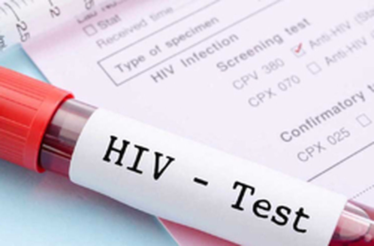 ماجراى فروش پستههاى آلوده به ویروس HIV در بازار