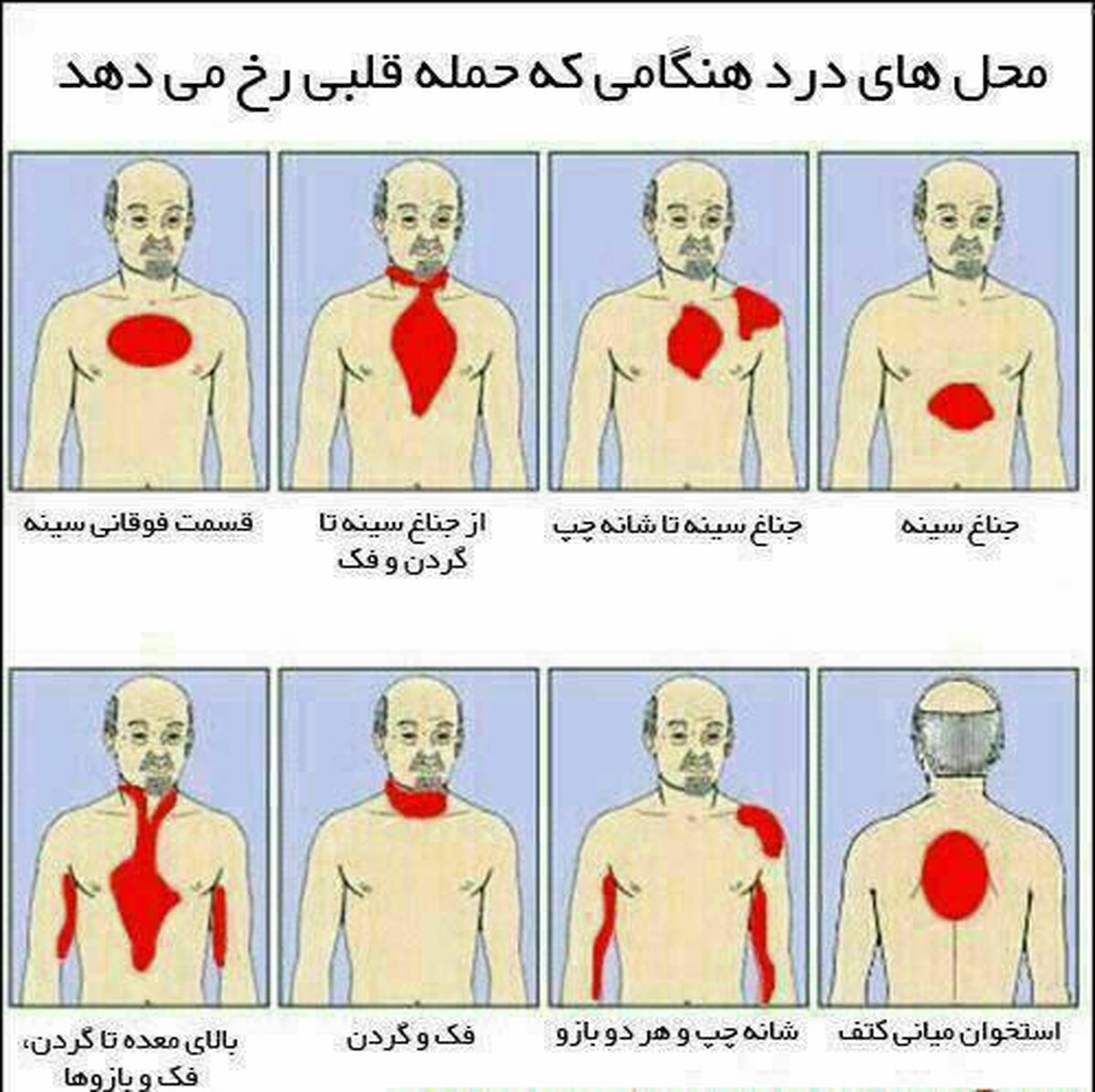 عکس: محل‌های درد هنگام حمله قلبی