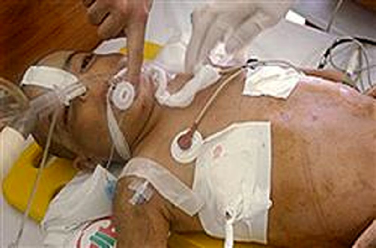 مرگ‌کودک5ساله‌زیرشلاق‌های ناپدری!/عکس