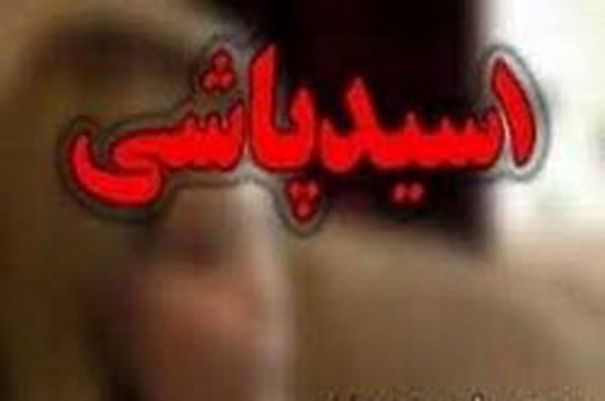اسیدپاشی پسر جوان روی نامادری اش در جنت آباد