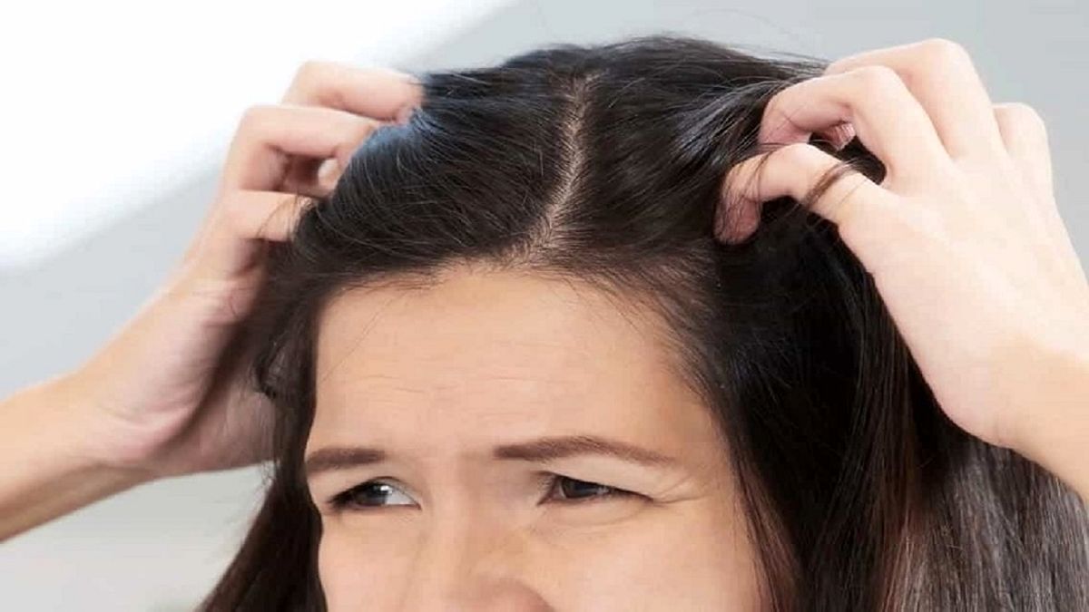 چرا به خارش سر مبتلا می شویم؟