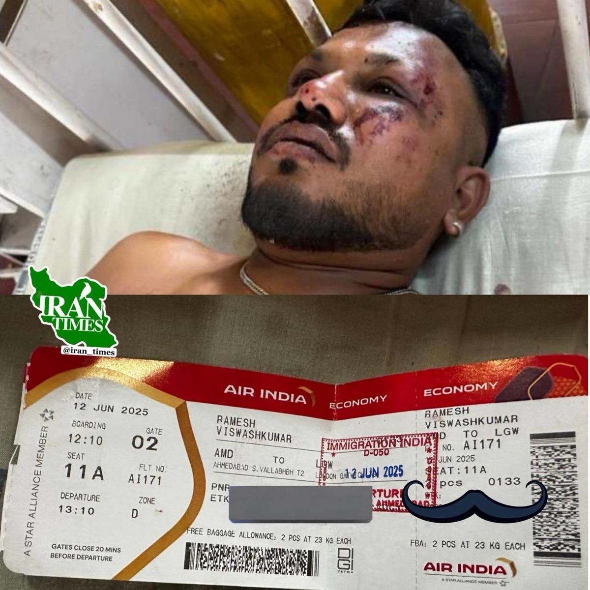 تنها بازمانده سقوط هواپیما در احمدآباد در آخرین لحظه از هواپیما بیرون پرید +عکس و فیلم