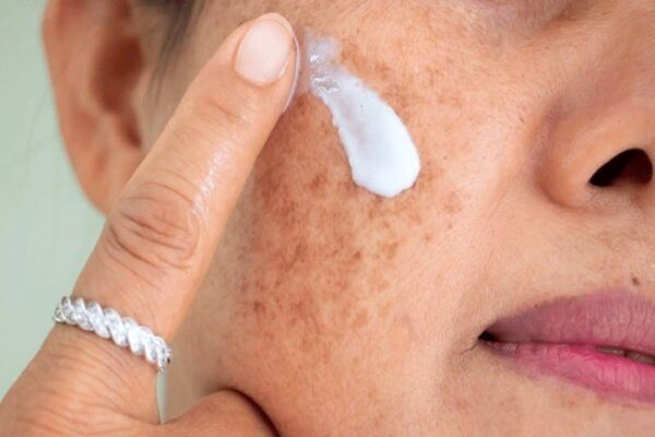 چه اشتباهاتی در تابستان به پوست آسیب میزند؟