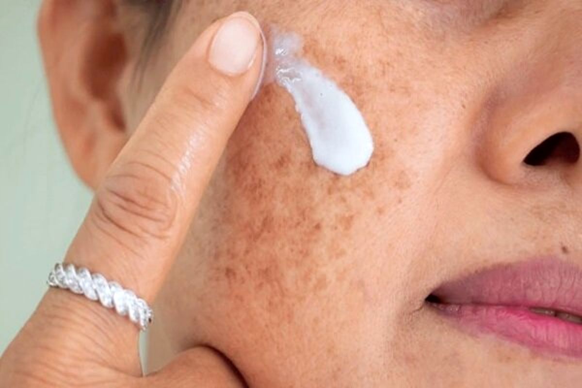 چه اشتباهاتی در تابستان به پوست آسیب می‌زند؟