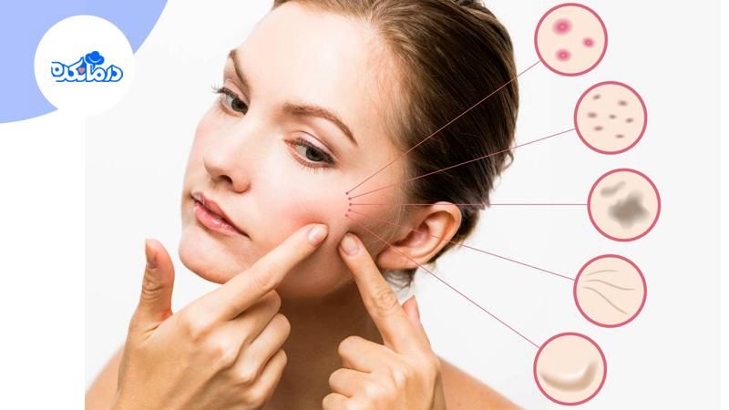 انواع بیماریهای پوستی، علائم، تشخیص و درمان آن