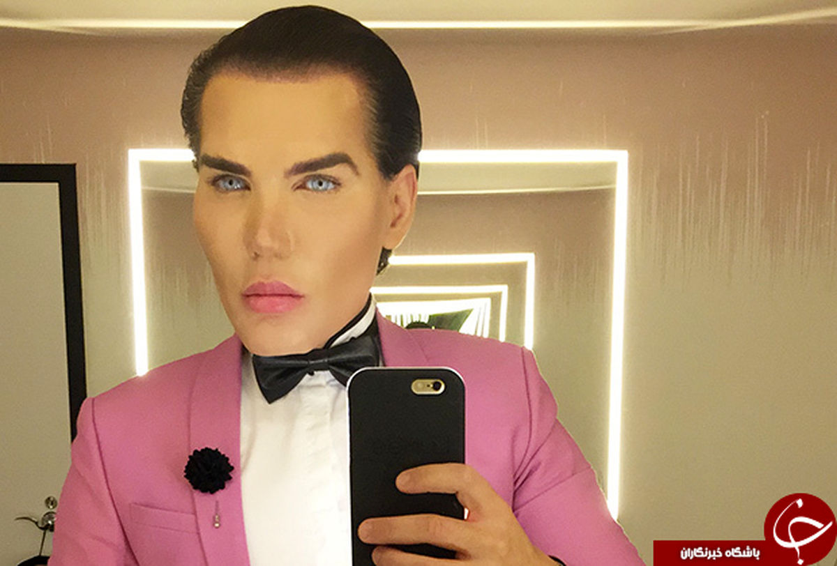 عجیب‌ترین عمل‌های جراحی پلاستیک +تصاویر