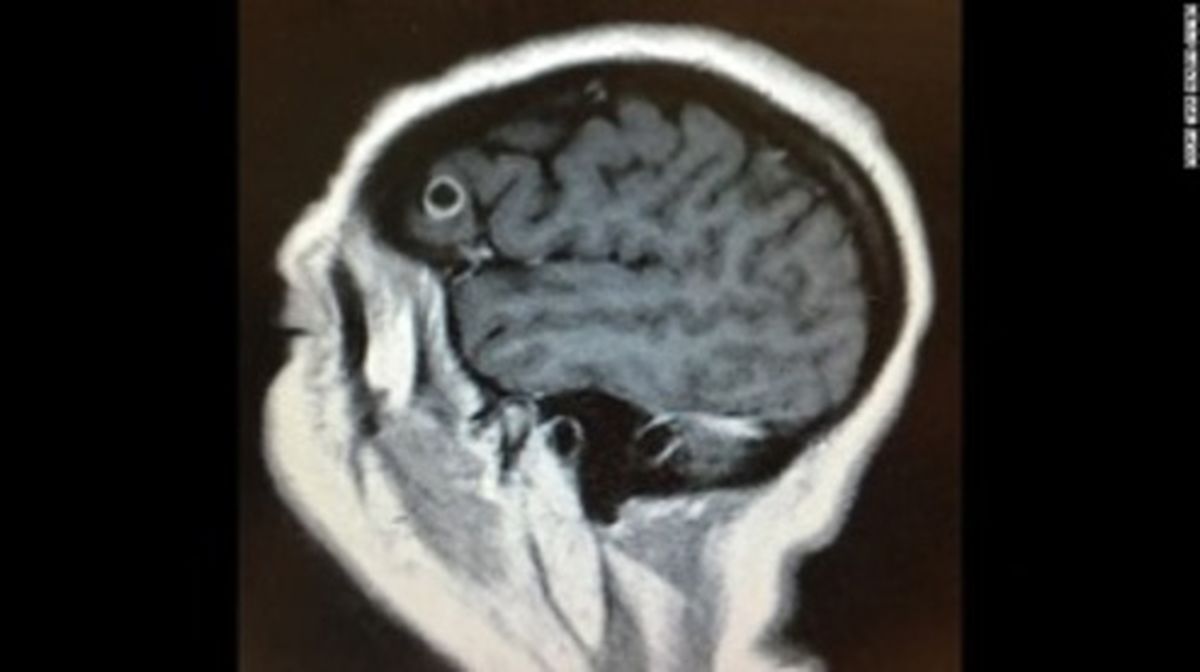 علت عجیب سردردهای یک راننده تاکسی! +عکس