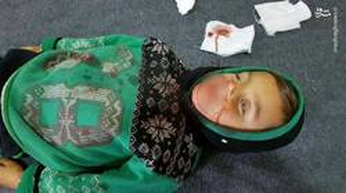 عکس: کودکی که قربانی سیاست‌های اردوغان شد