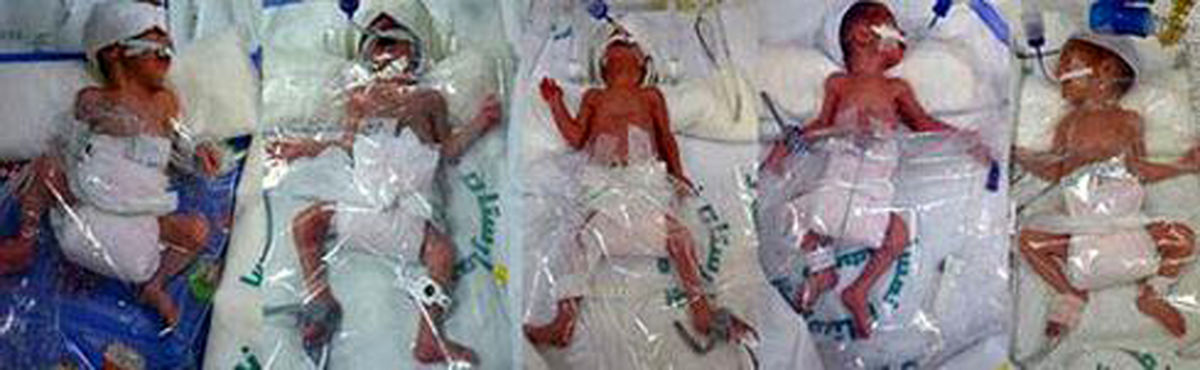 تولد ۵ قلوهای یک کیلوگرمی در شیراز +عکس