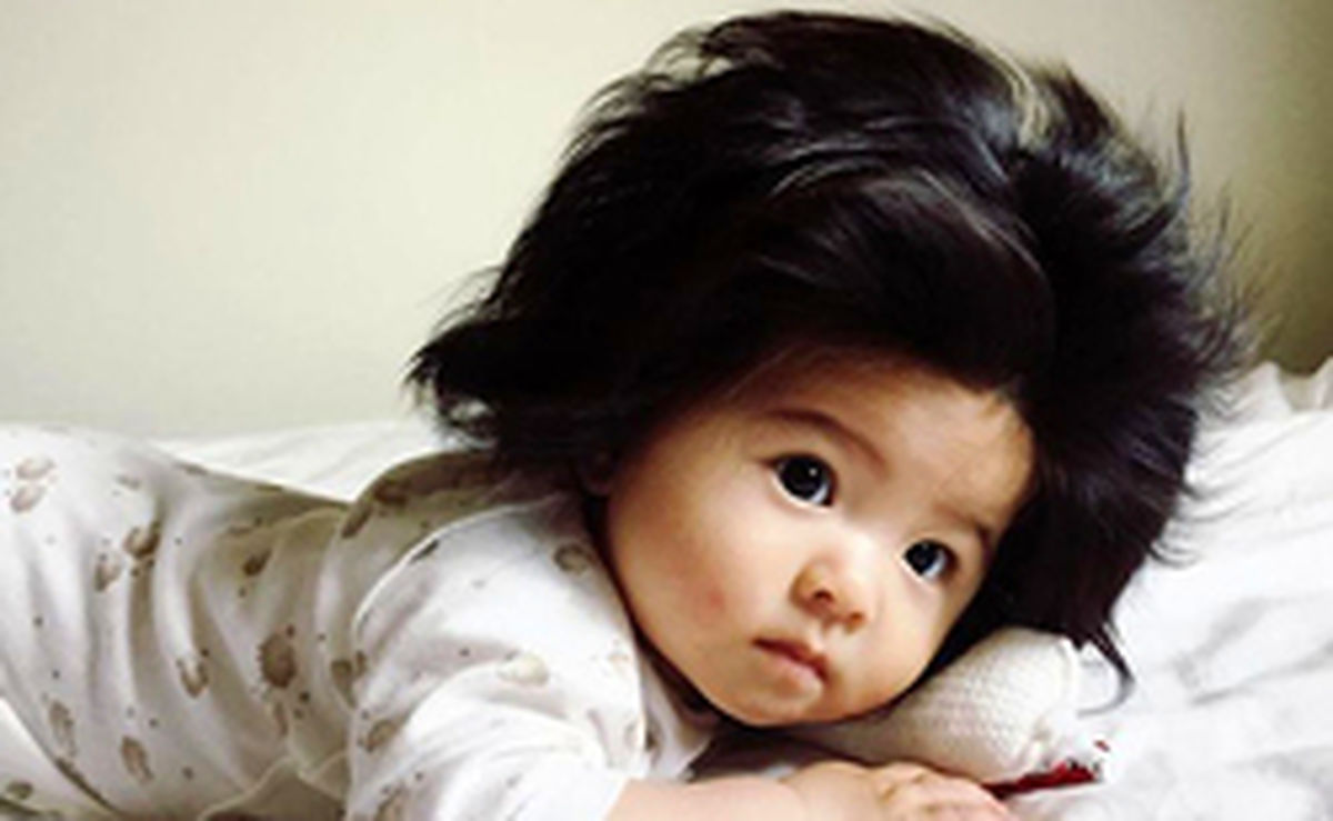 تصاویر: چهره باورنکردنی یک نوزاد شش ماهه