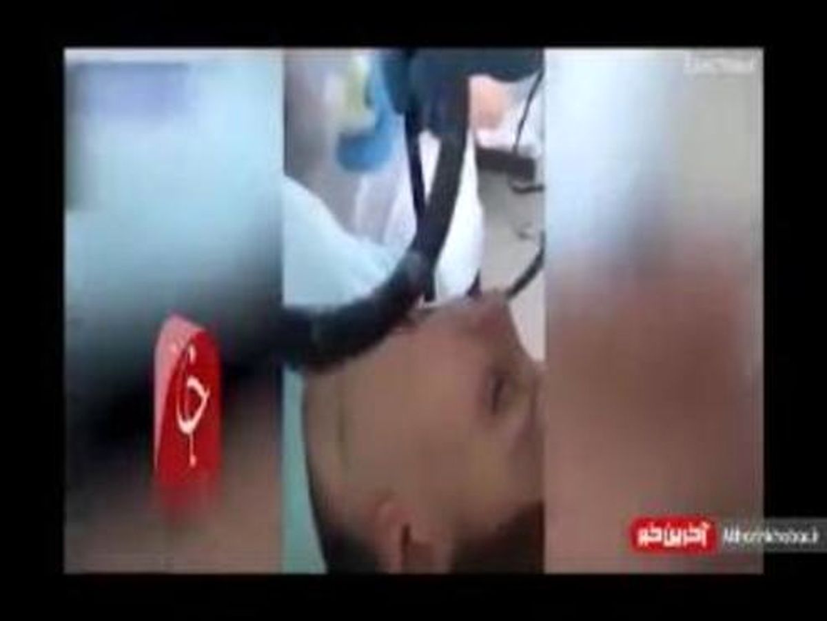 ماری که هنگام خواب وارد دهان زن روس شد! +فیلم