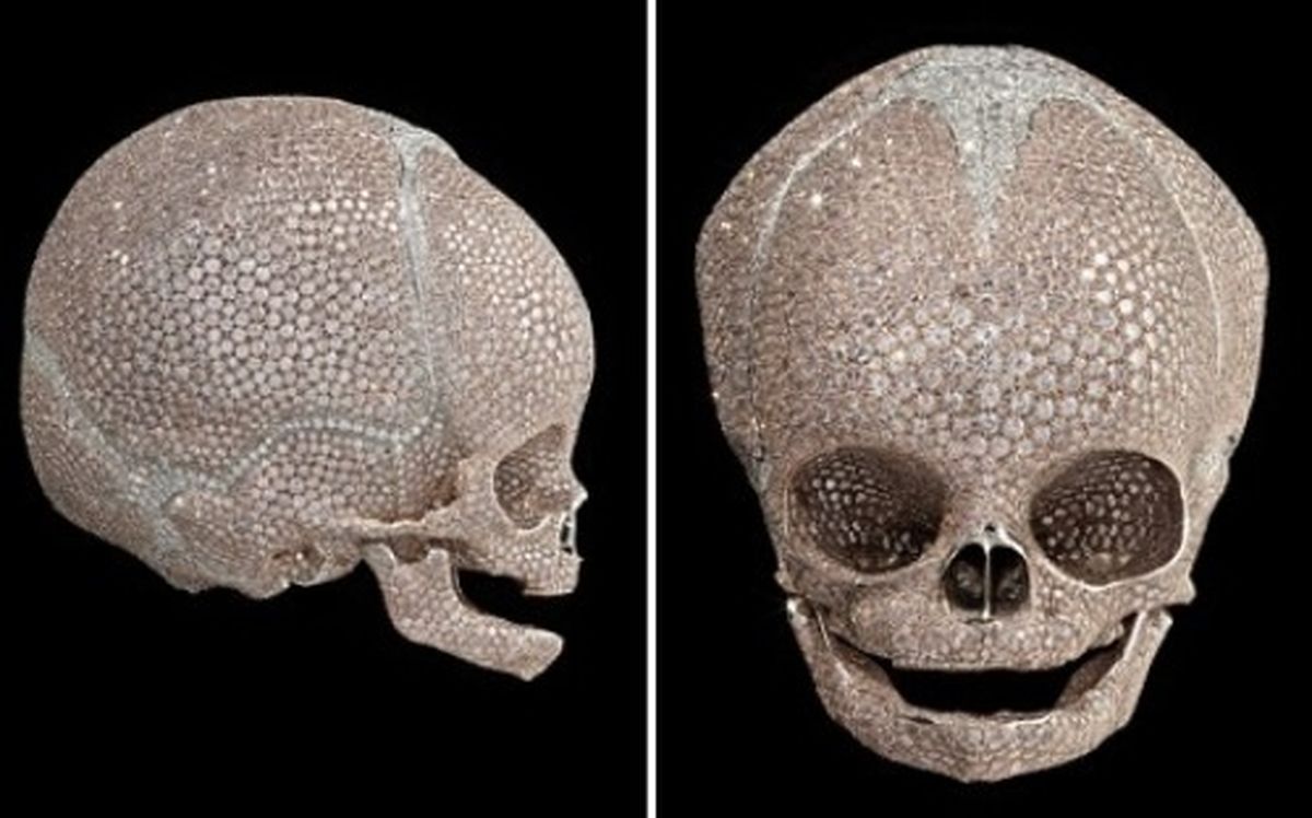 جمجمه کودک کار دست هنرمند داد + عکس