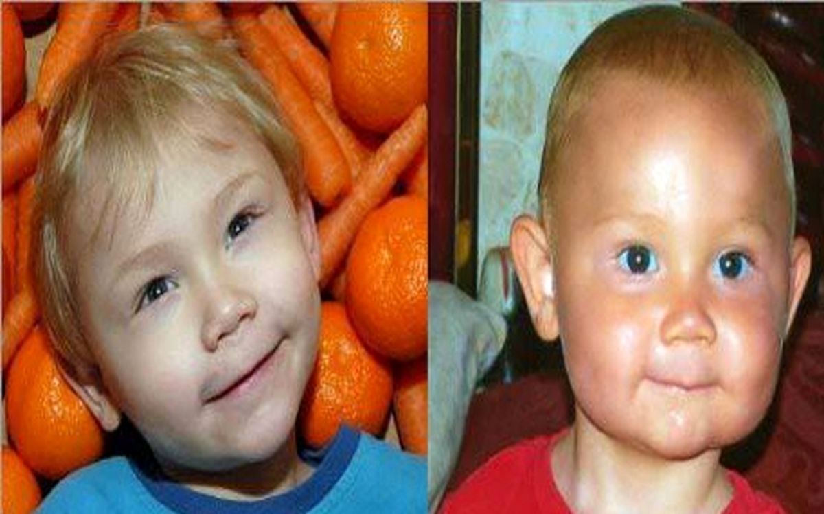 پسری که با خوردن هویج، نارنجی می‌شود! +تصاویر