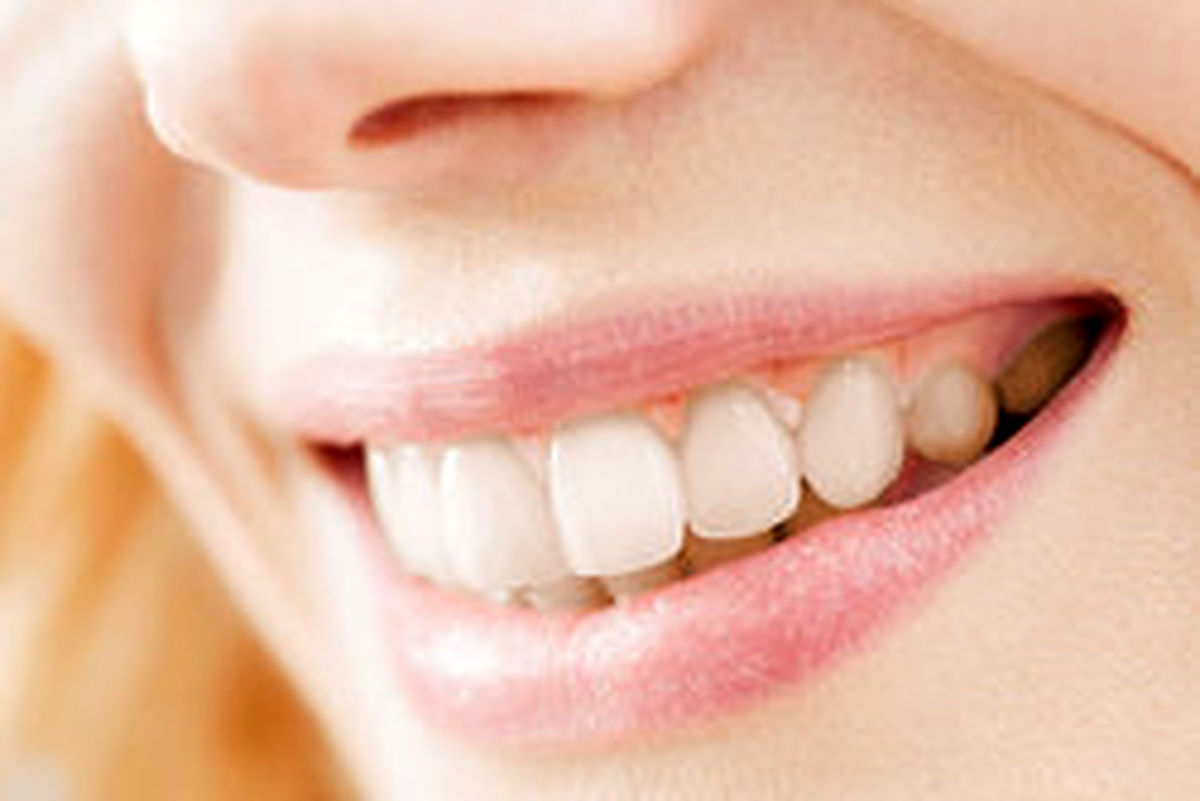 چرا دندانها زرد میشوند؟
