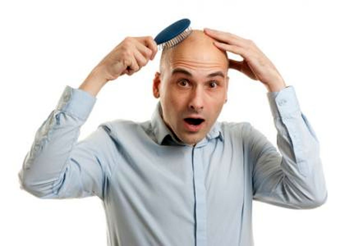 حقایقی جالب درباره طاسی مردانه که نمی‌دانید