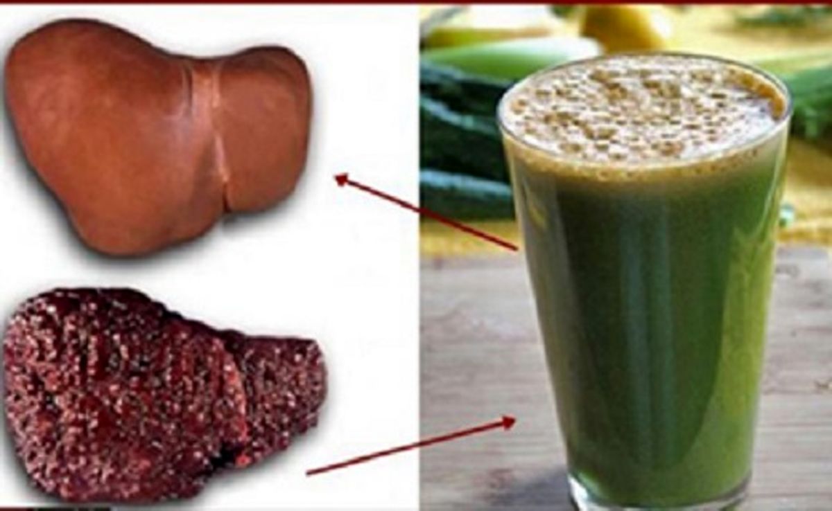 شوینده ای برای کبد چرب + عکس