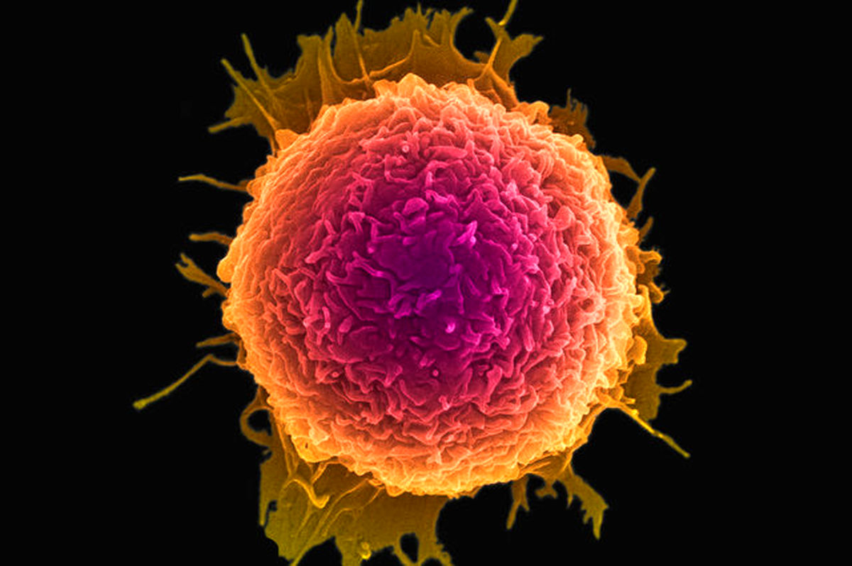 این توده‌های غیرسرطانی نیازی به درمان ندارند