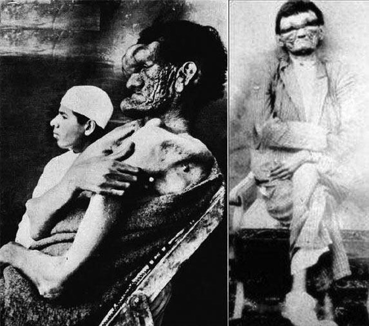 عجیب الخلقه ترین مرد ایران +عکس