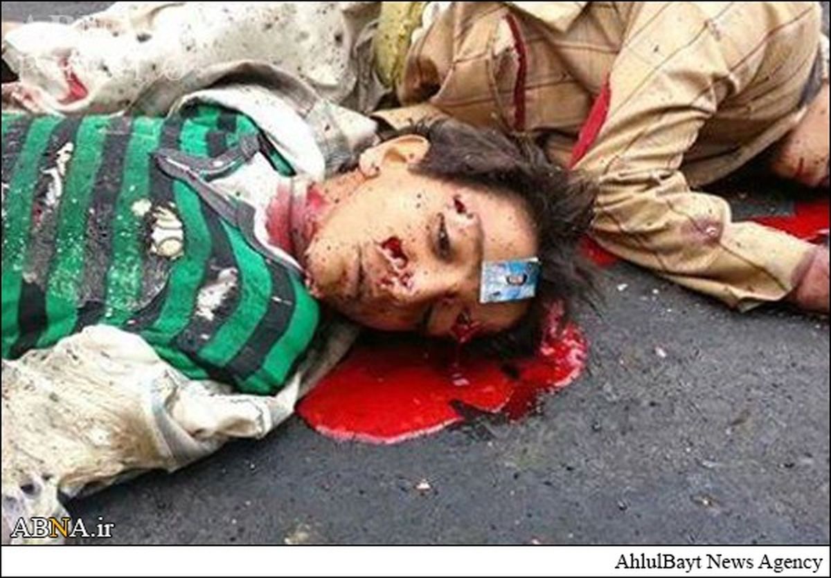 انفجار انتحاری امروز در صنعاء/تصاویر(۱۸+)