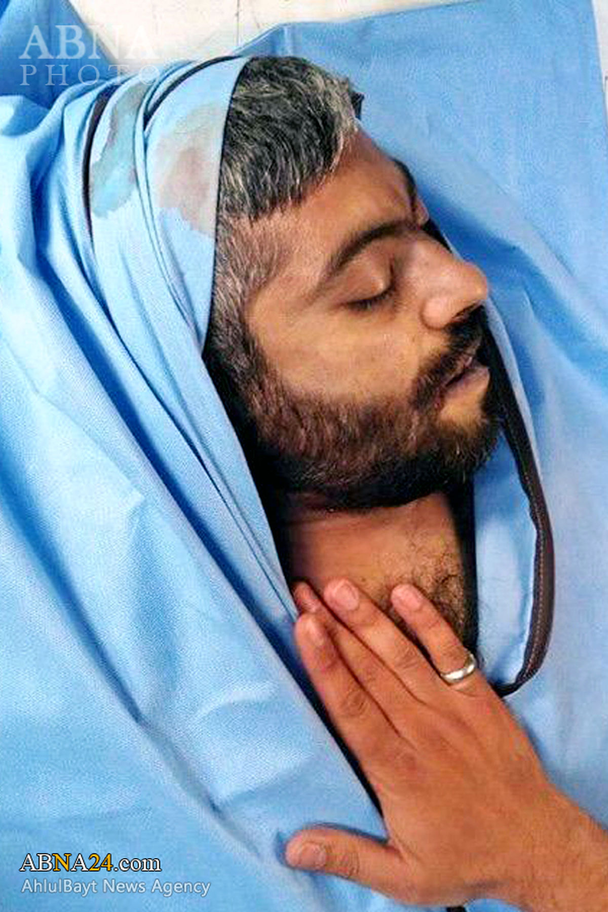 حاج «نادر حمید» پس از شهادت + عکس