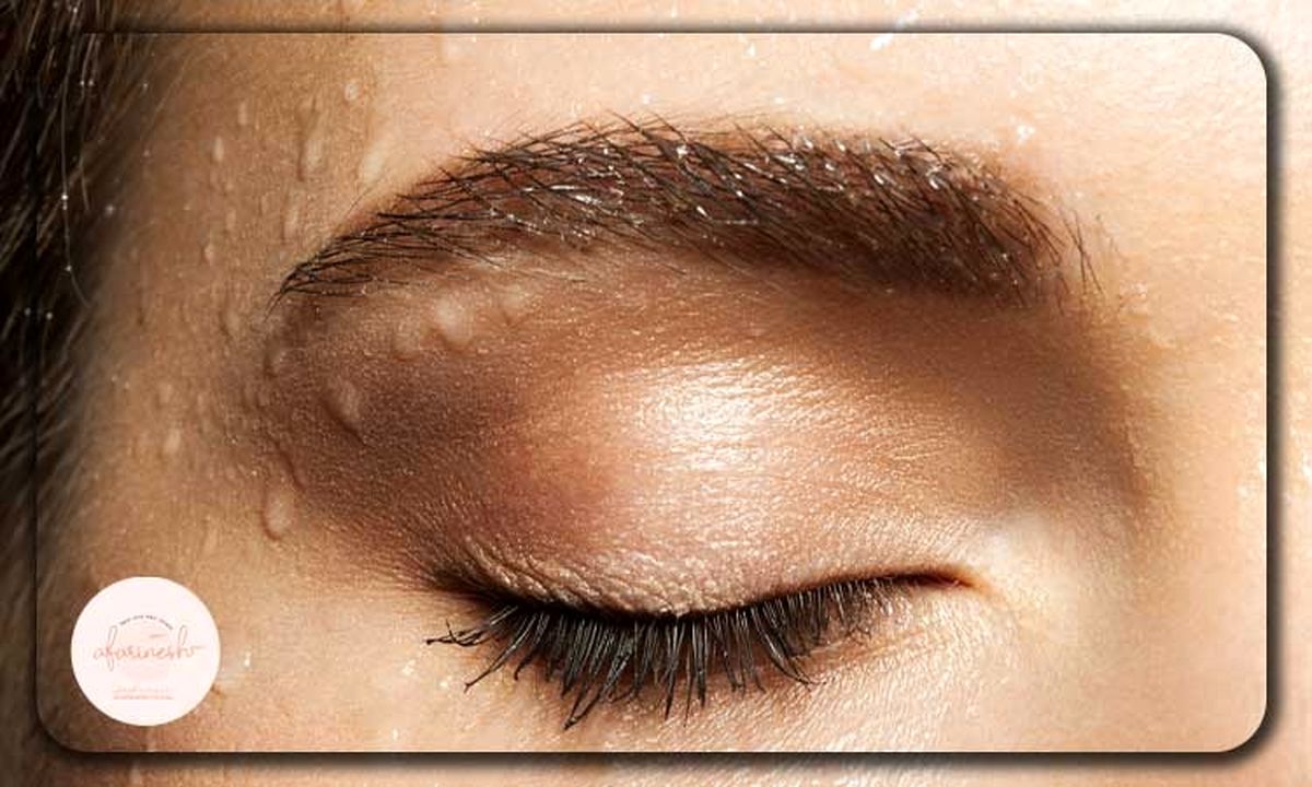 تحلیل علمی روش های نوین کاشت ابرو و عوارض احتمالی