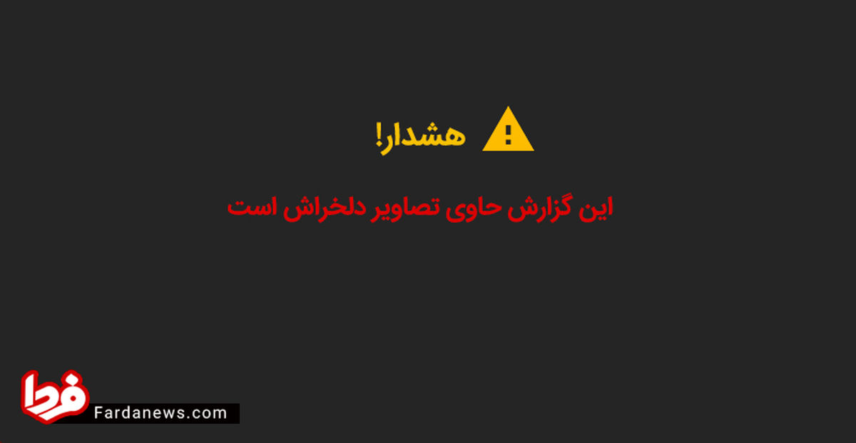 تصاویر رویترز از بلایی که عربستان بر سر کودکان یمن آورد