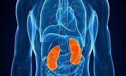 قاتل کلیه‌ها را بشناسید