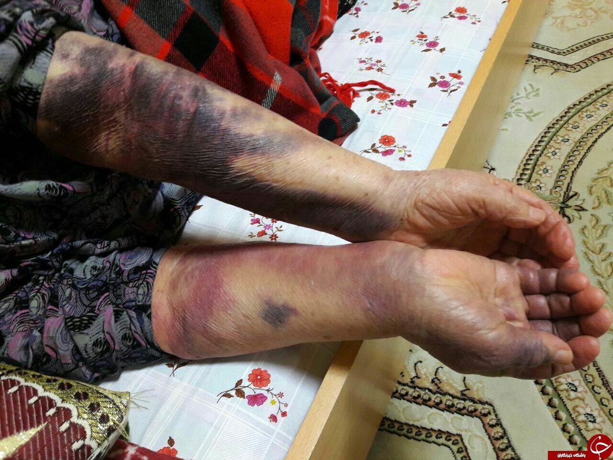 اشتباهات مکرر تزریق خون و سرم برای یک بیمار +تصاویر