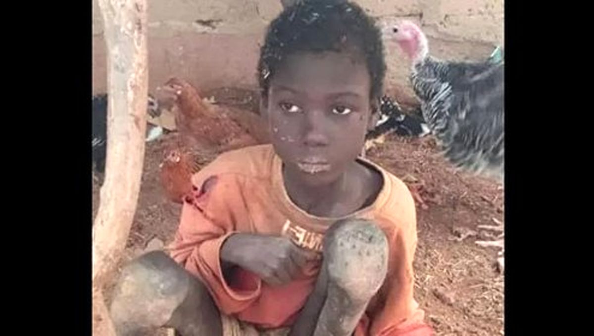 کودکی که دو سال در طویله غل و زنجیر بود! +فیلم