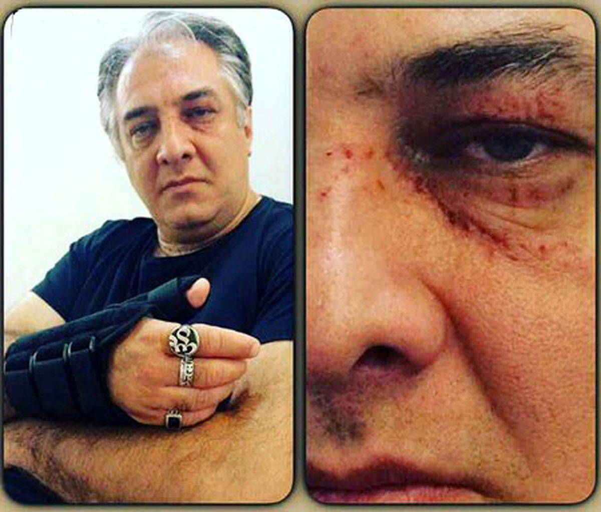 ایرج نوذری دچار سانحه شد + عکس