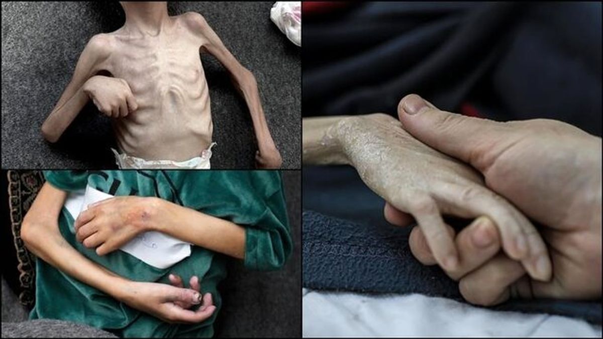 اخبار غزه | شهادت ۶۰ کودک در غزه در ۶۰۰ روز گذشته 