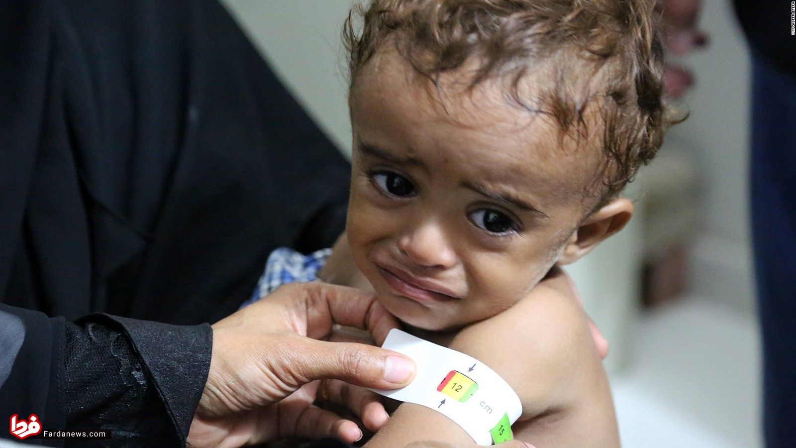 محاصره یمن به زبان ساده/ صحنه مقاومت مردم، وطن‌فروشی منصورهادی و جنایت سعودی‌ها