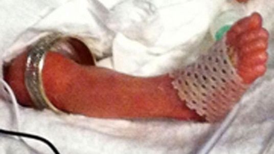 معجزه‌ای دوباره /عکس