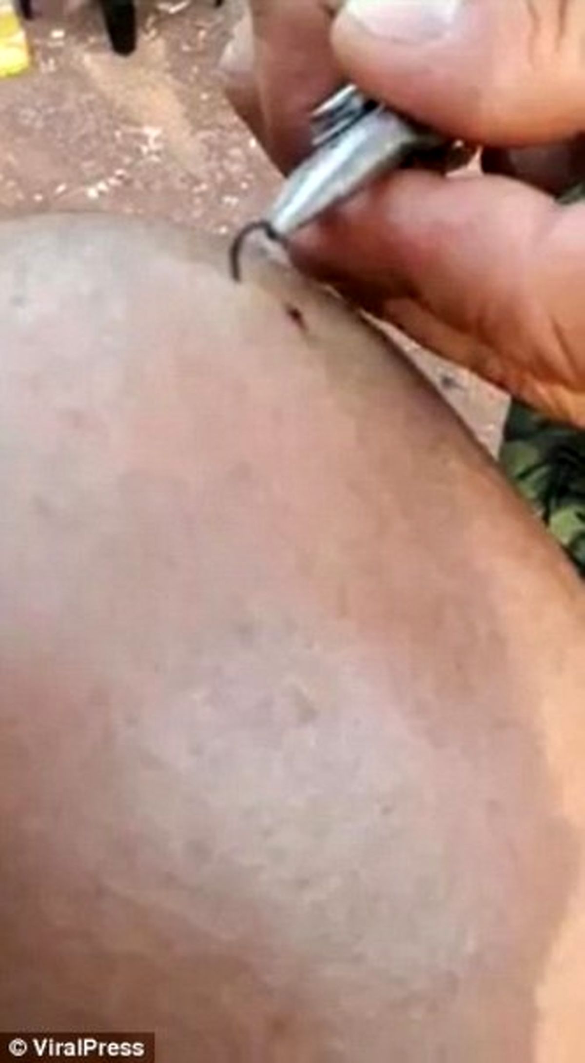 ماهیگیری که در قلاب خود گرفتار شد! +تصاویر (۱۸+)