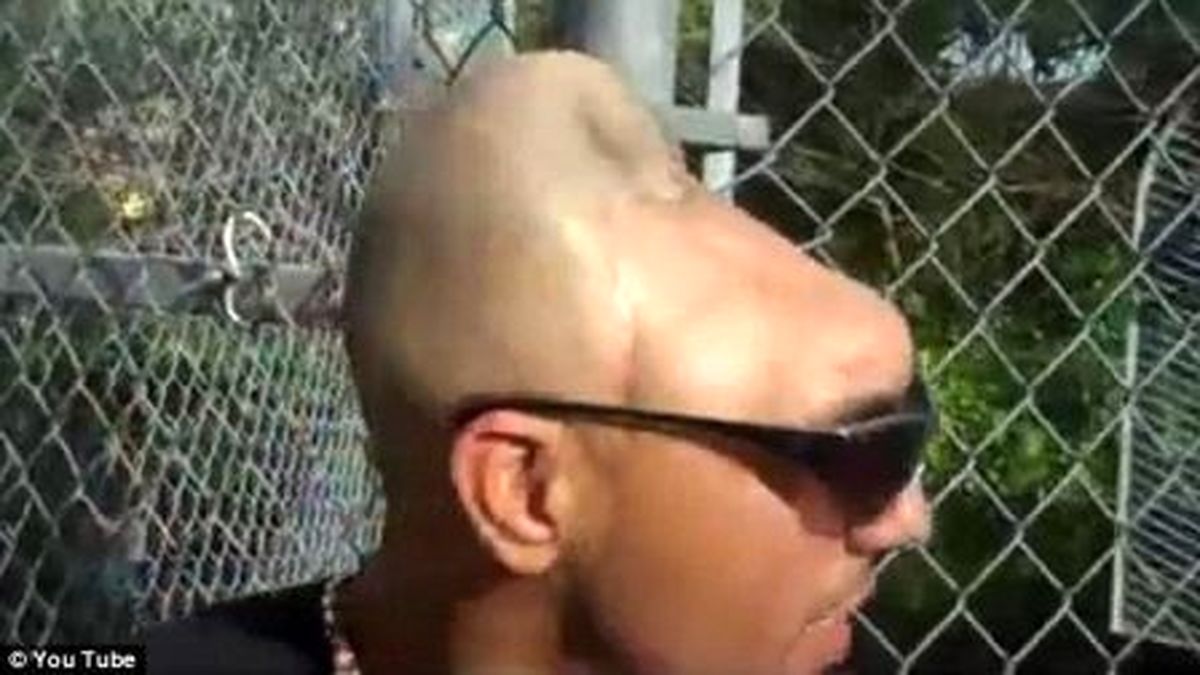 هشدار مردی با سر نصف شده/تصویر