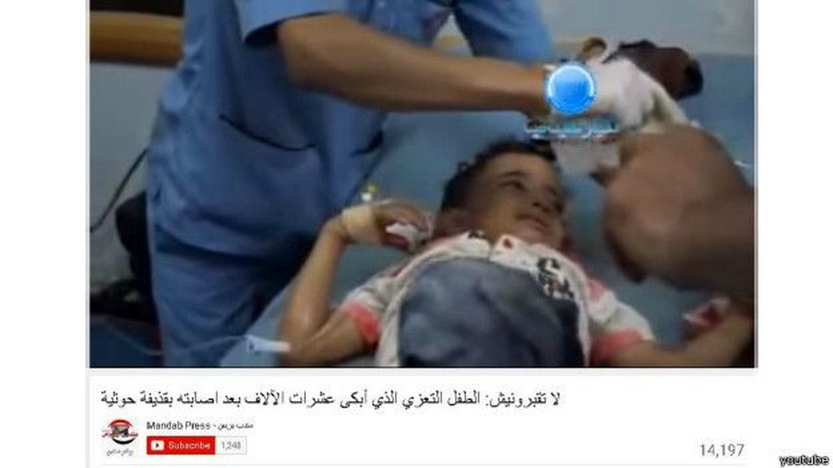 کودک یمنی: "من را دفن نکنید"!