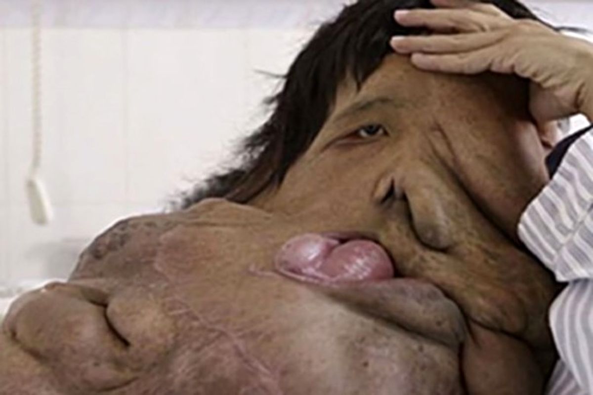 تلاش «فیل‌مرد» چینی برای زنده ماندن +تصاویر