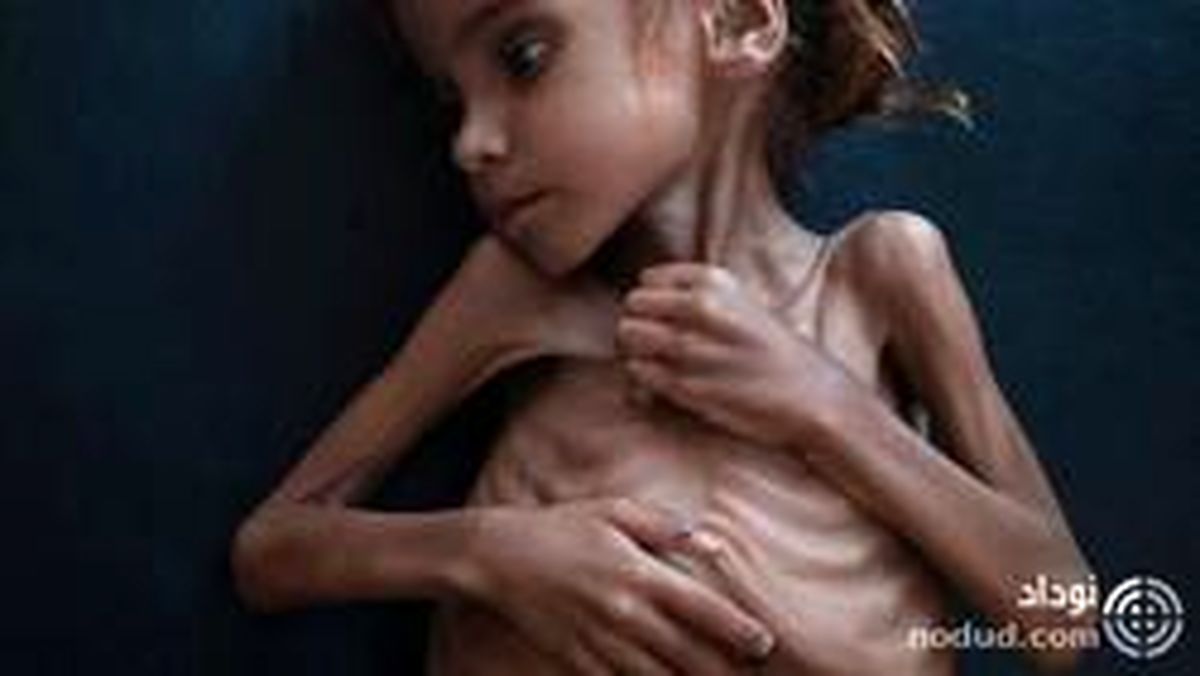 مرگ دختر ۷ ساله‌ای که تصویرش جهان را تکان داد! +عکس