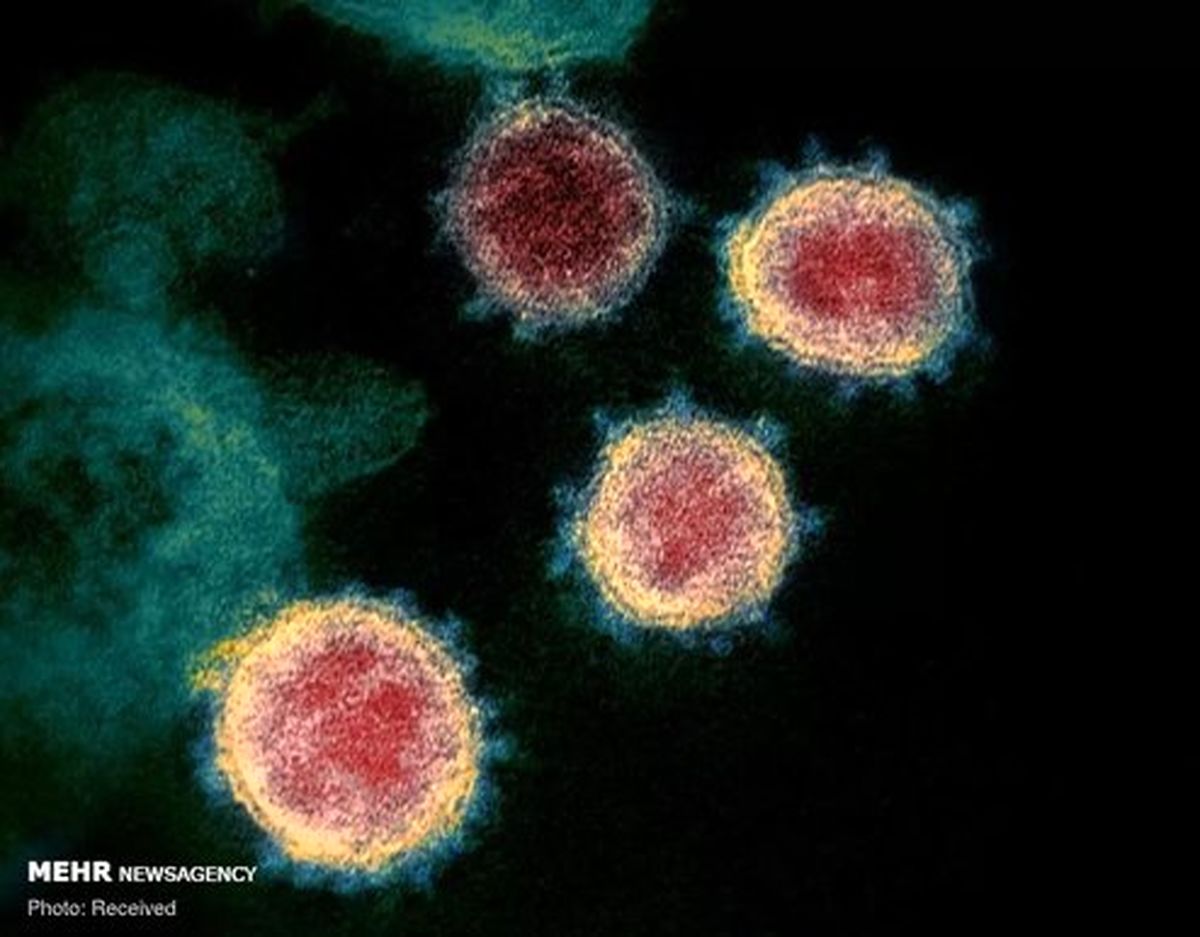 تصاویر: کرونا ویروس زیر میکروسکوپ
