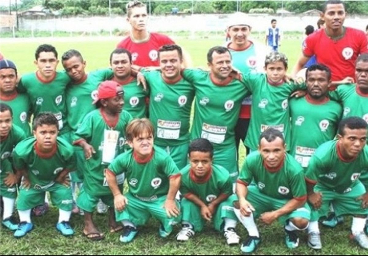 تیم فوتبال کوتوله‌ها در برزیل/تصاویر