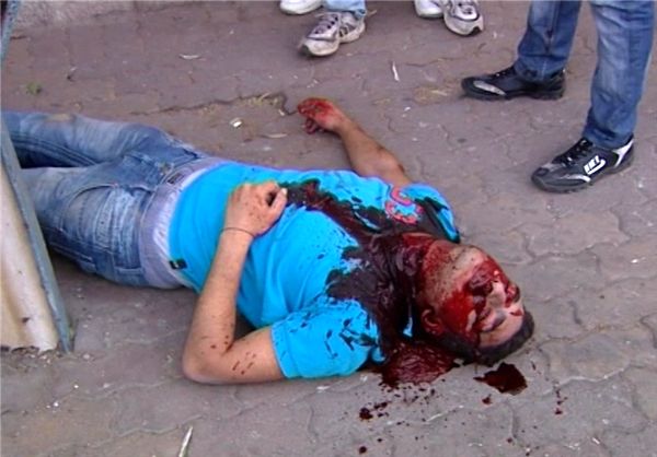 مسئول خون این جوان کیست/عکس