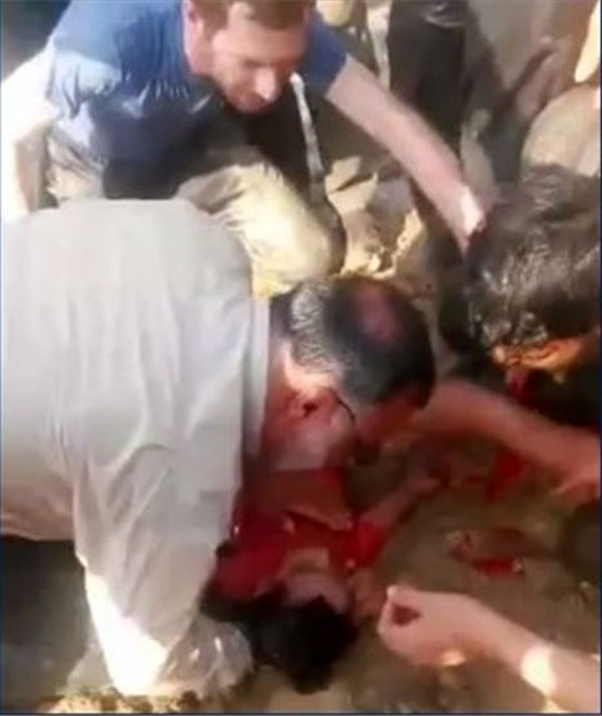 زاکانی جان یک کودک را نجات داد/عکس