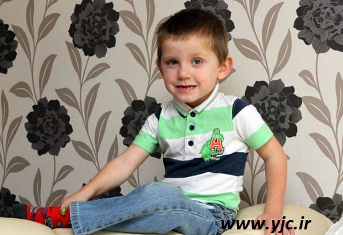کودکی با خشن ترین بیماری دنیا / عکس