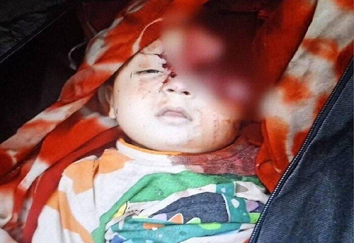  مادر و کودک ایرانی تیتر رسانه‌های جهان شدند +عکس