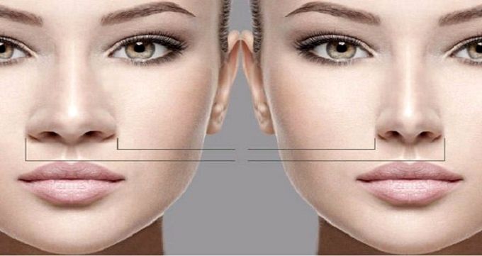 معرفی بهترین جراح بینی گوشتی، استخوانی و پروتز سینه در تهران